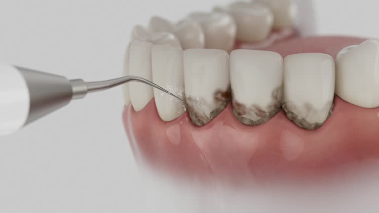 Reliable Dental Implants contractor in Beechwood, MI by Smile Center Dentistry